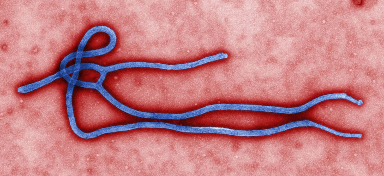 Those with Ebola symptoms in Cornwall will be transferred to Ottawa