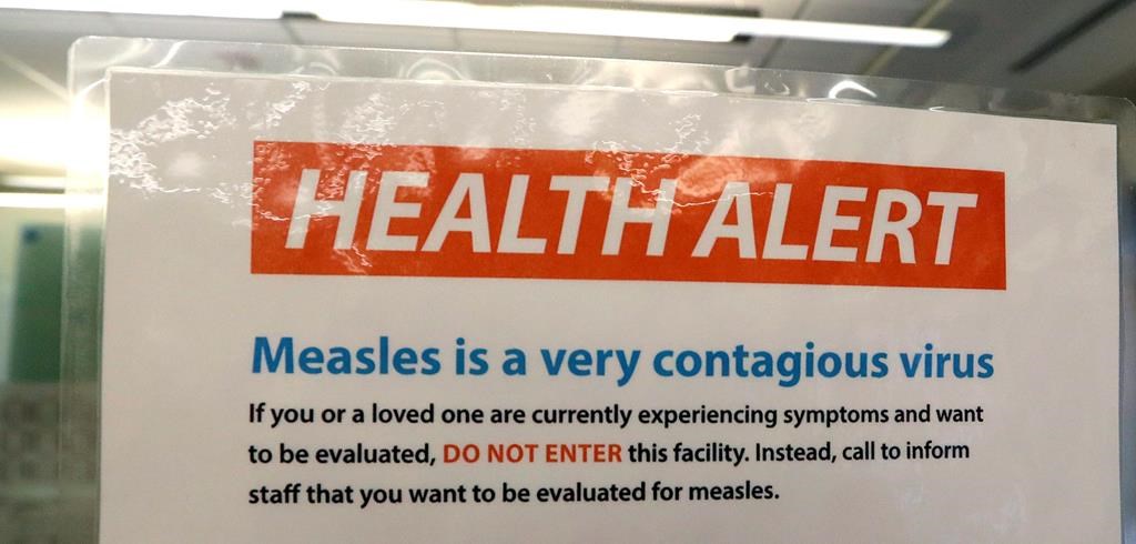 Toronto Public Health confirms second case of measles in 2024